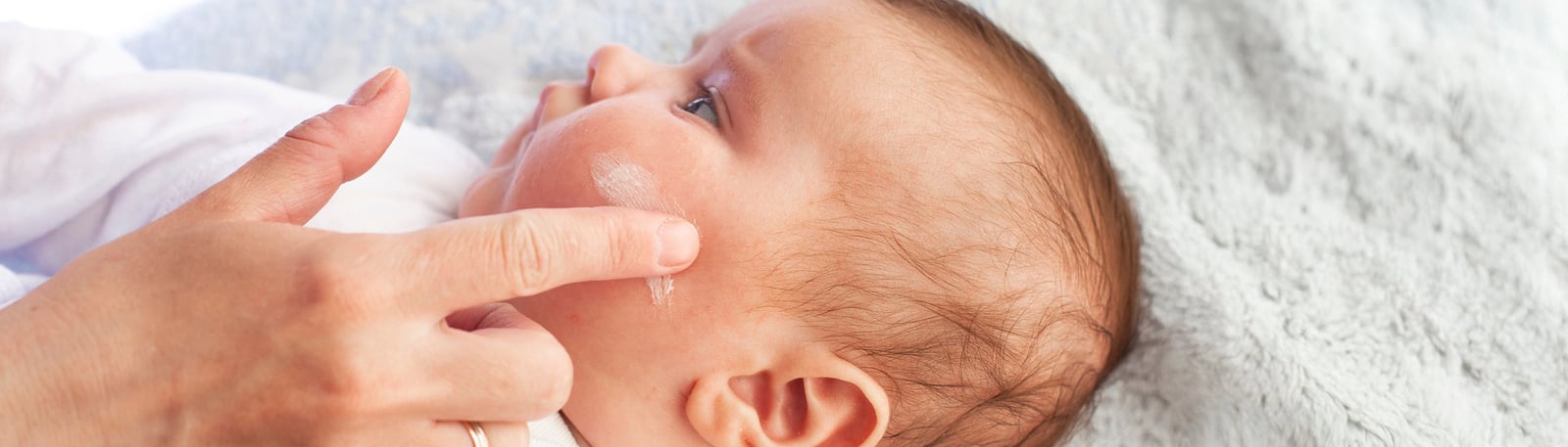 Eksem hos barn & hur du lindrar – apoteksteknikern guidar