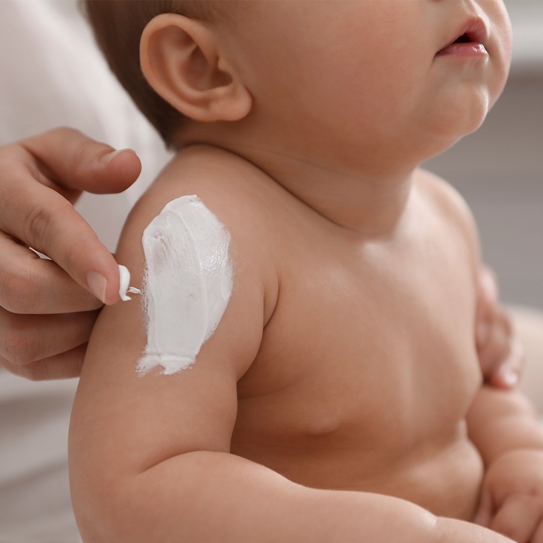 Så tar du hand om din bebis hud och undviker hudbesvär