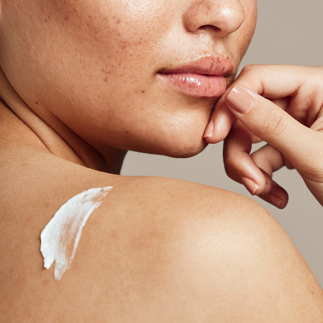 Extremt torr hud? Vanliga orsaker & krämerna som hjälper