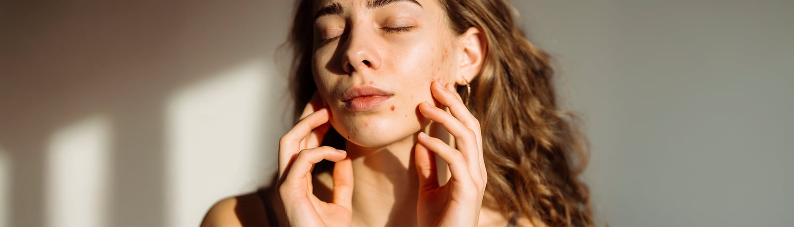 Fått utslag i ansiktet? Farmaceuten om orsaker & behandling