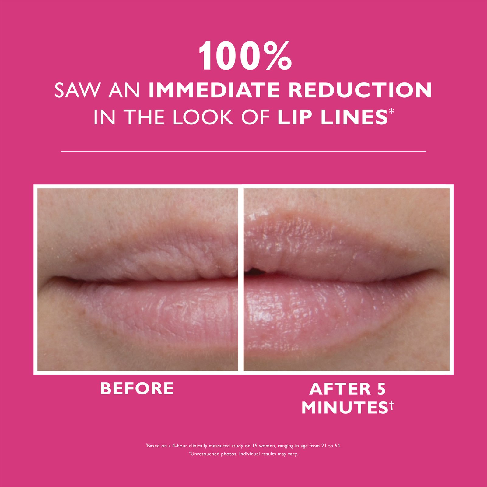 Peter Thomas Roth Instant FIRMx® Lip Filler 10 ml