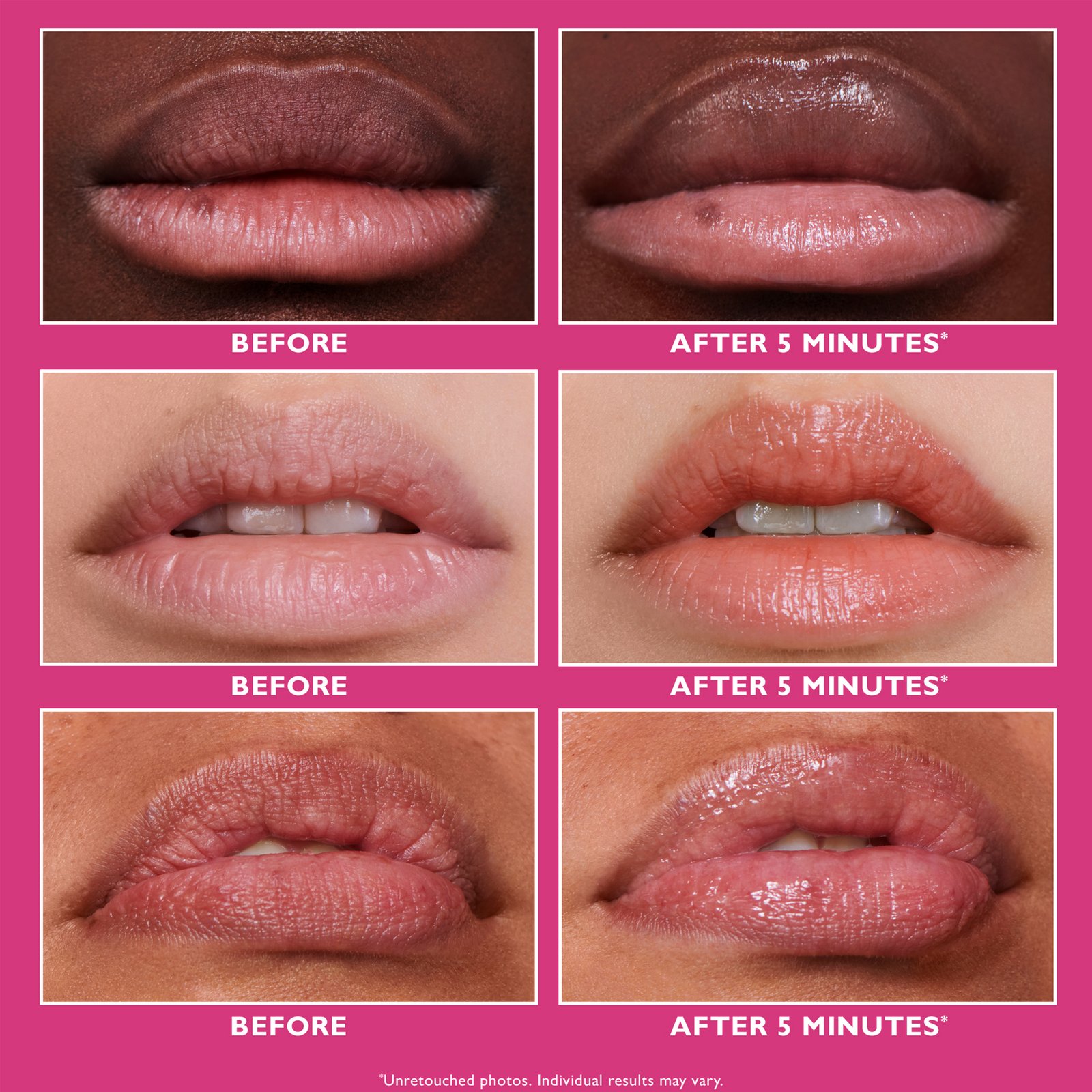 Peter Thomas Roth Instant FIRMx® Lip Filler 10 ml