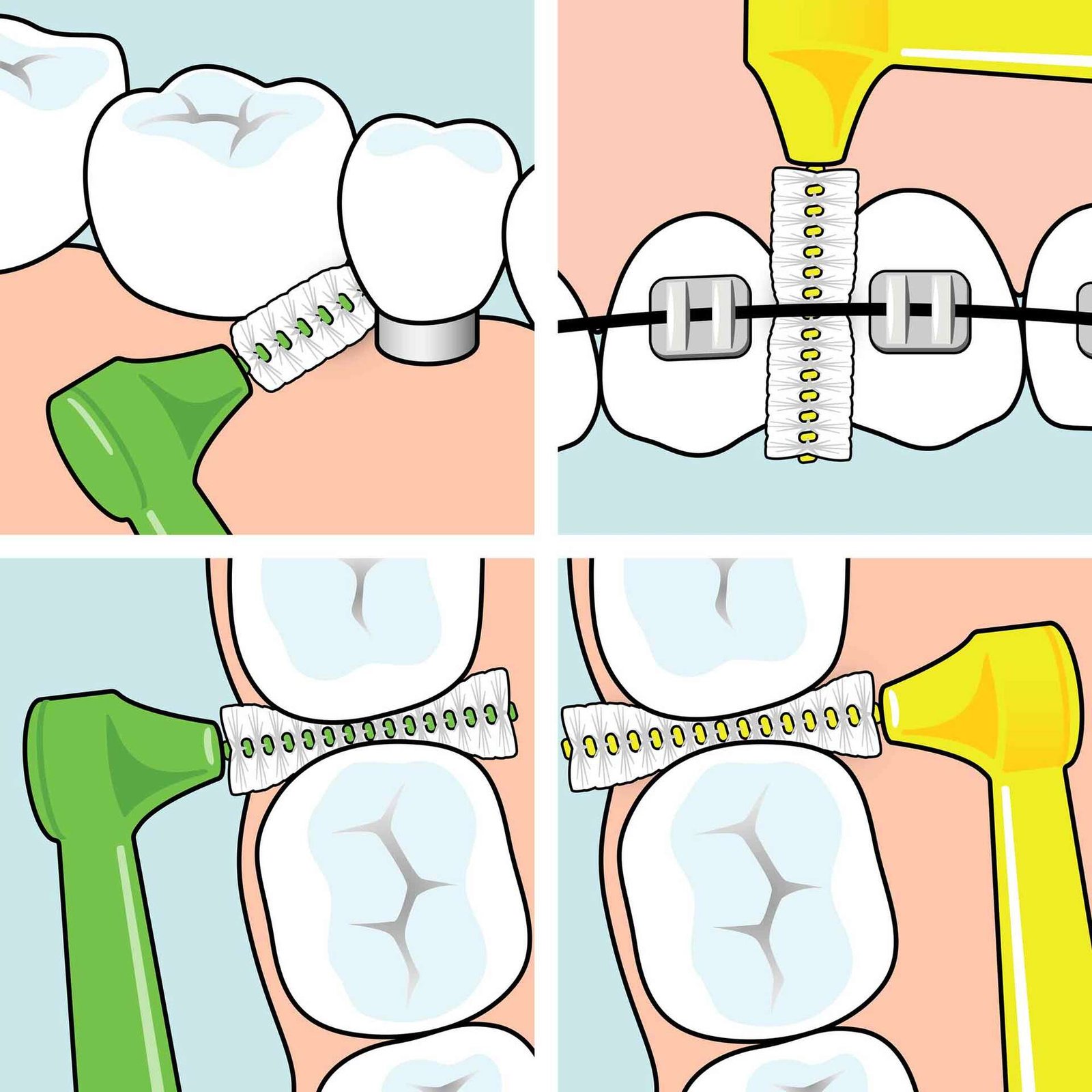 TePe Angle Vinklad Mellanrumsborste Mixpack 6-pack