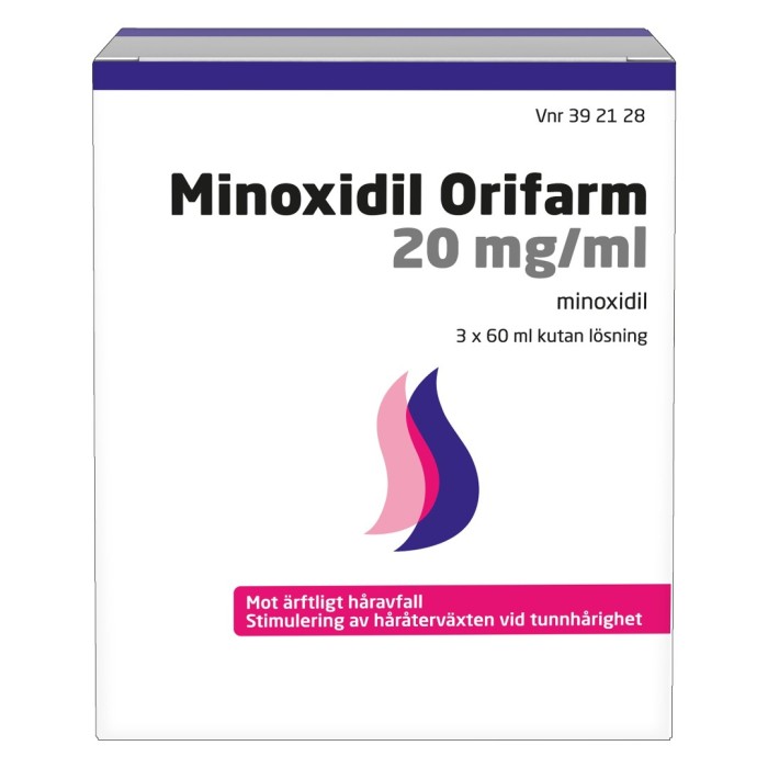 Minoxidil Orifarm 20 mg/ml Kutan Lösning 3 x 60 ml