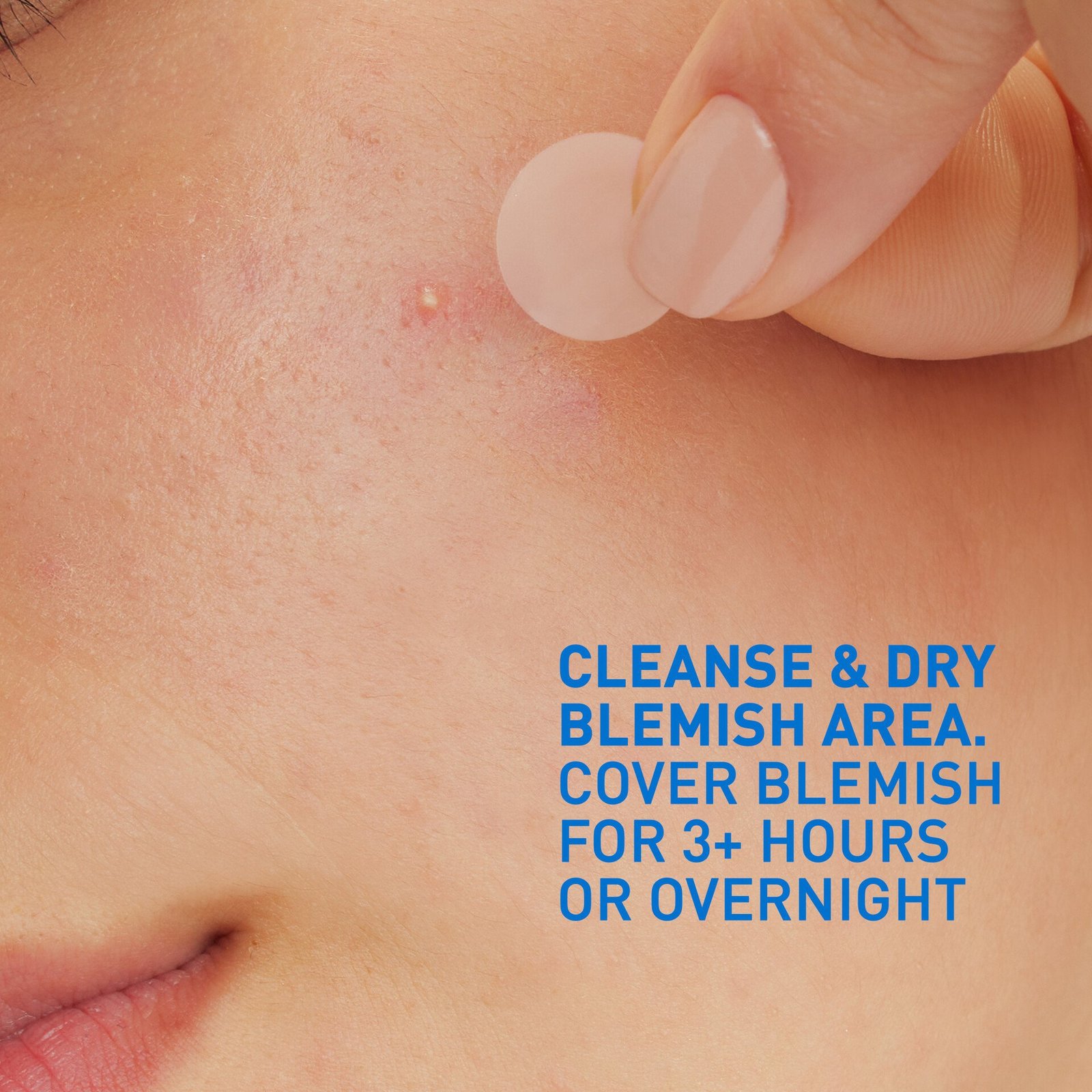 CeraVe Blemish Barrier Patches 22 st