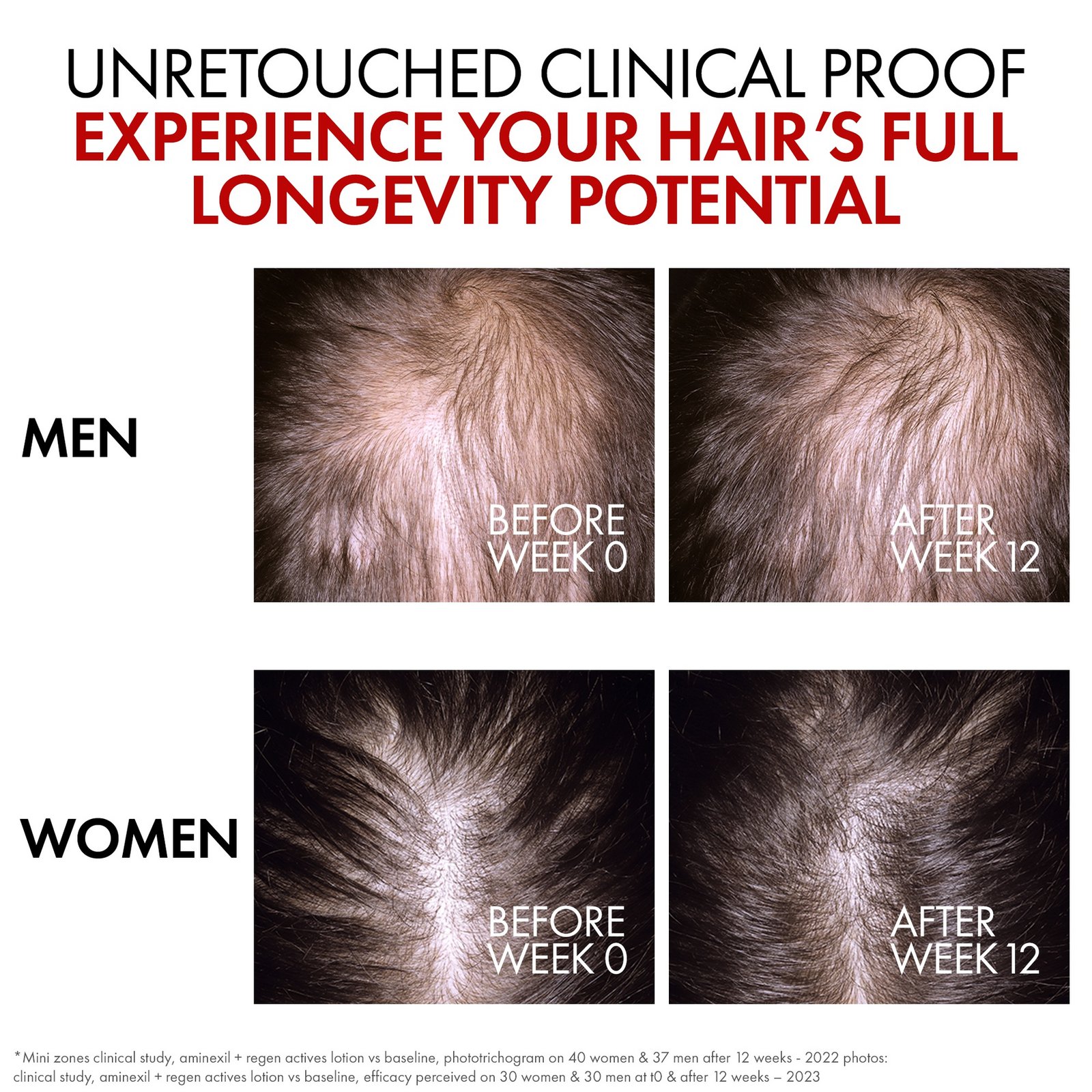 Vichy Dercos Aminexil R.E.G.E.N. Booster 90 ml