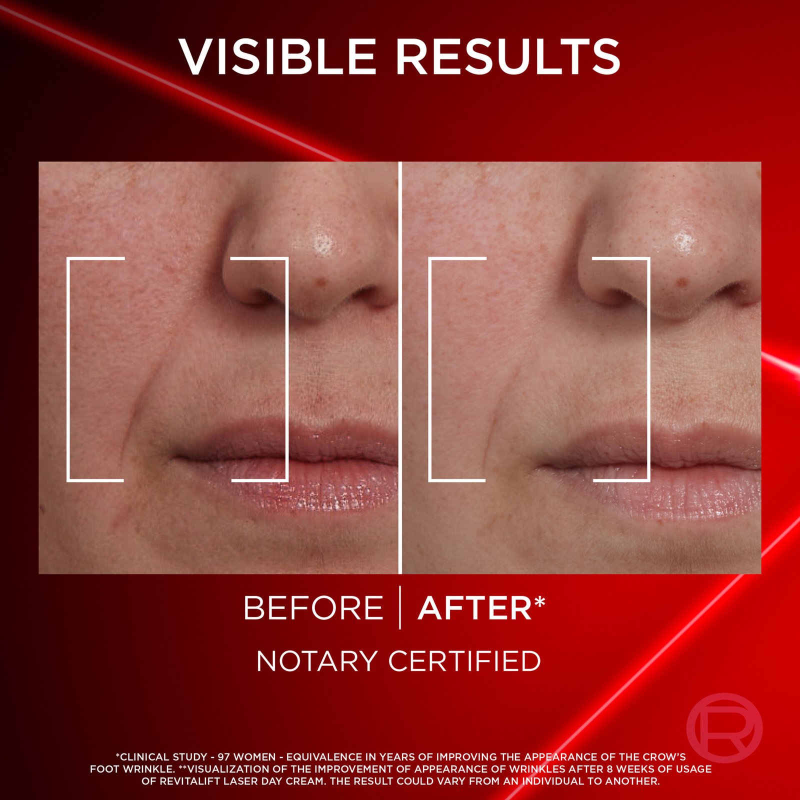 L'Oréal Paris Revitalift Laser Day Cream  50 ml