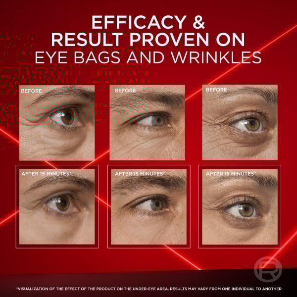 L'Oréal Paris Revitalift Laser Eye Bag Eraser 15 ml