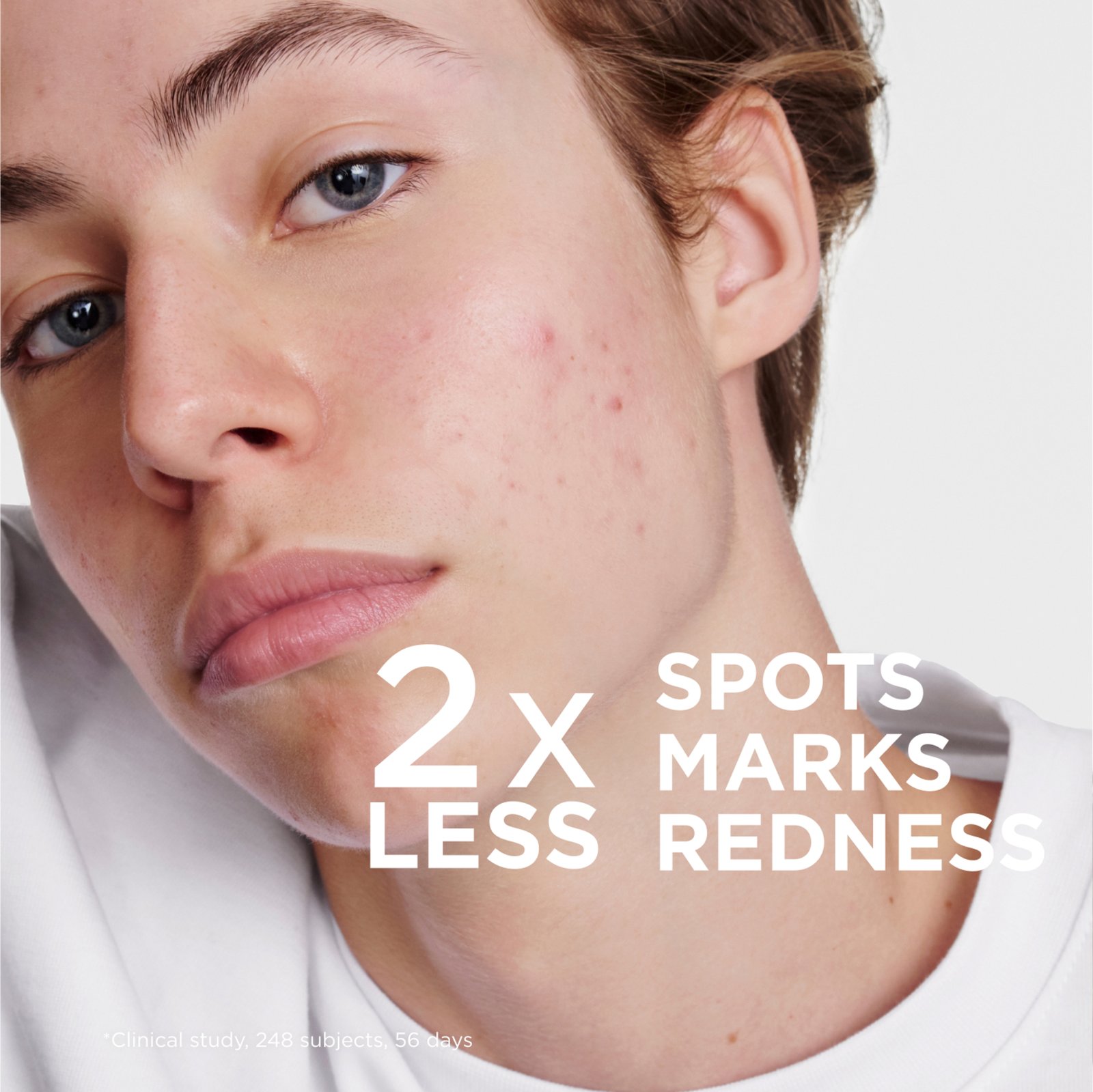 Bioderma Sébium Kerato+ 30 ml