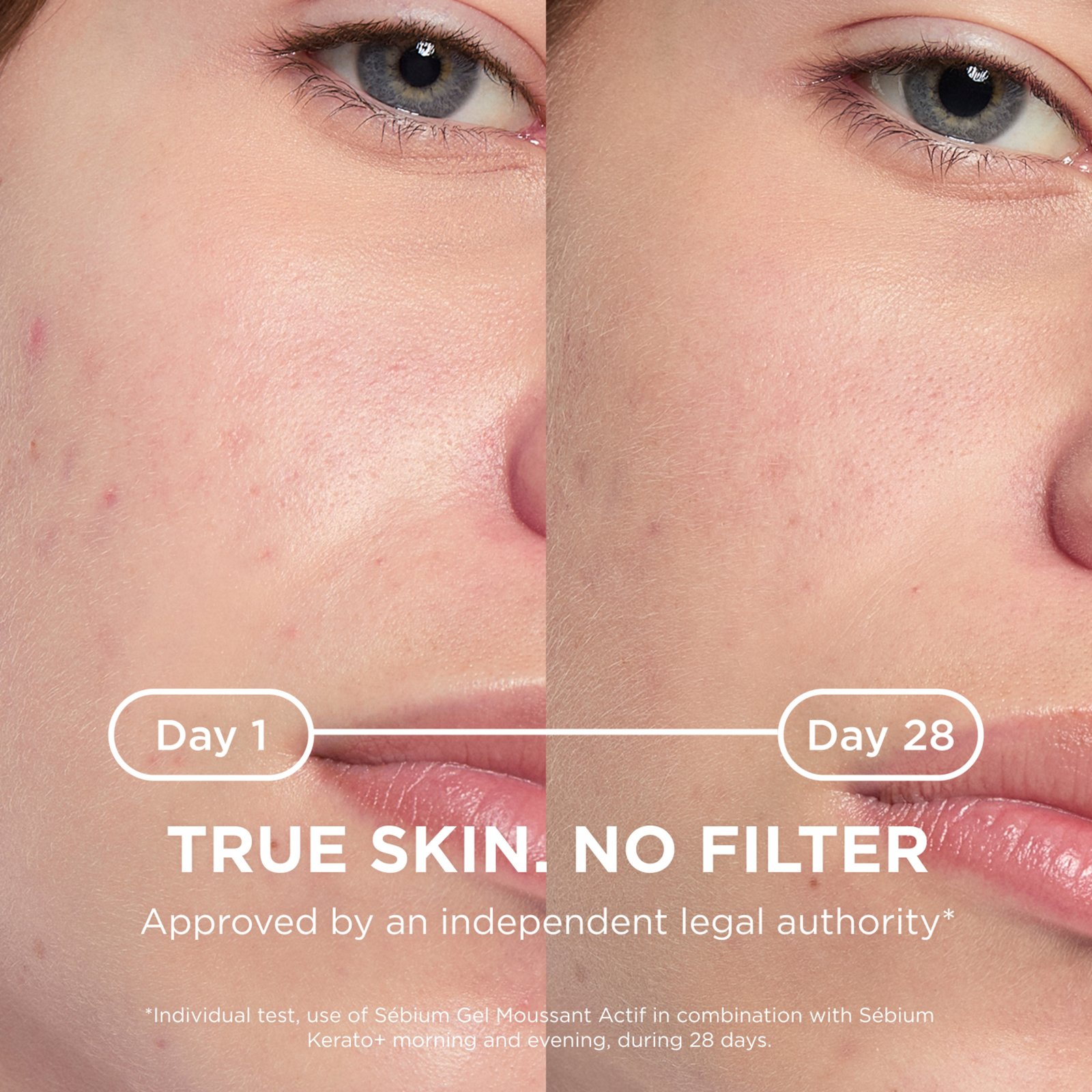 Bioderma Sébium Kerato+ 30 ml