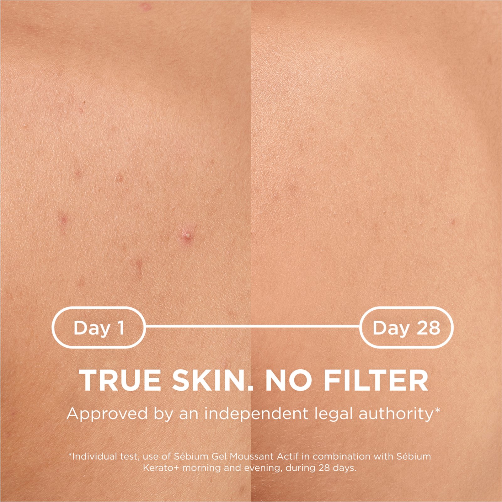 Bioderma Sébium Body Spray 150 ml