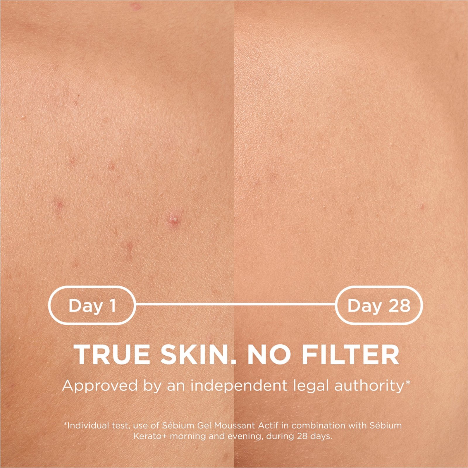 Bioderma Sébium Body Spray 150 ml