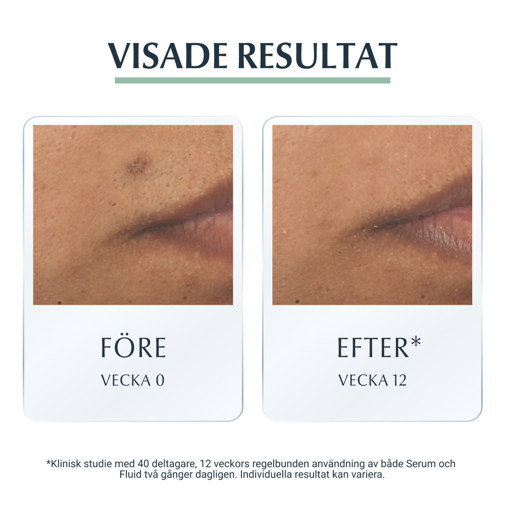 Eucerin DermoPurifyer Tripple Effekt Serum 40 ml