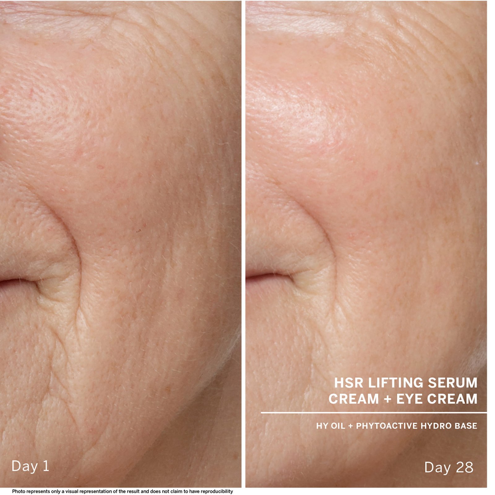 Babor HSR anti-wrinkle serum 30 ml
