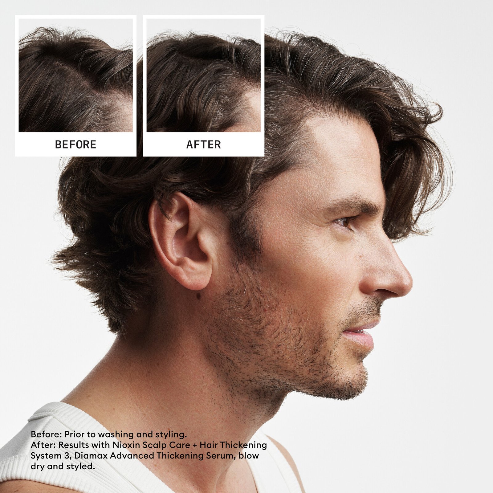 Nioxin System 2 Loyalty Kit