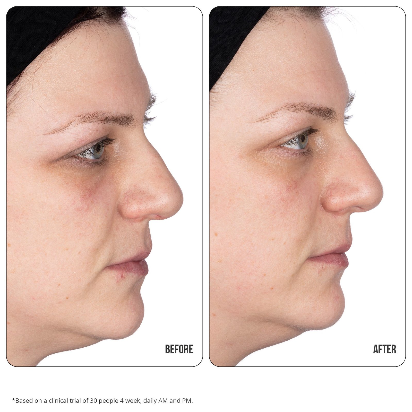 NIP+FAB Vitamin C 10% Fix Eye Cream 15 ml