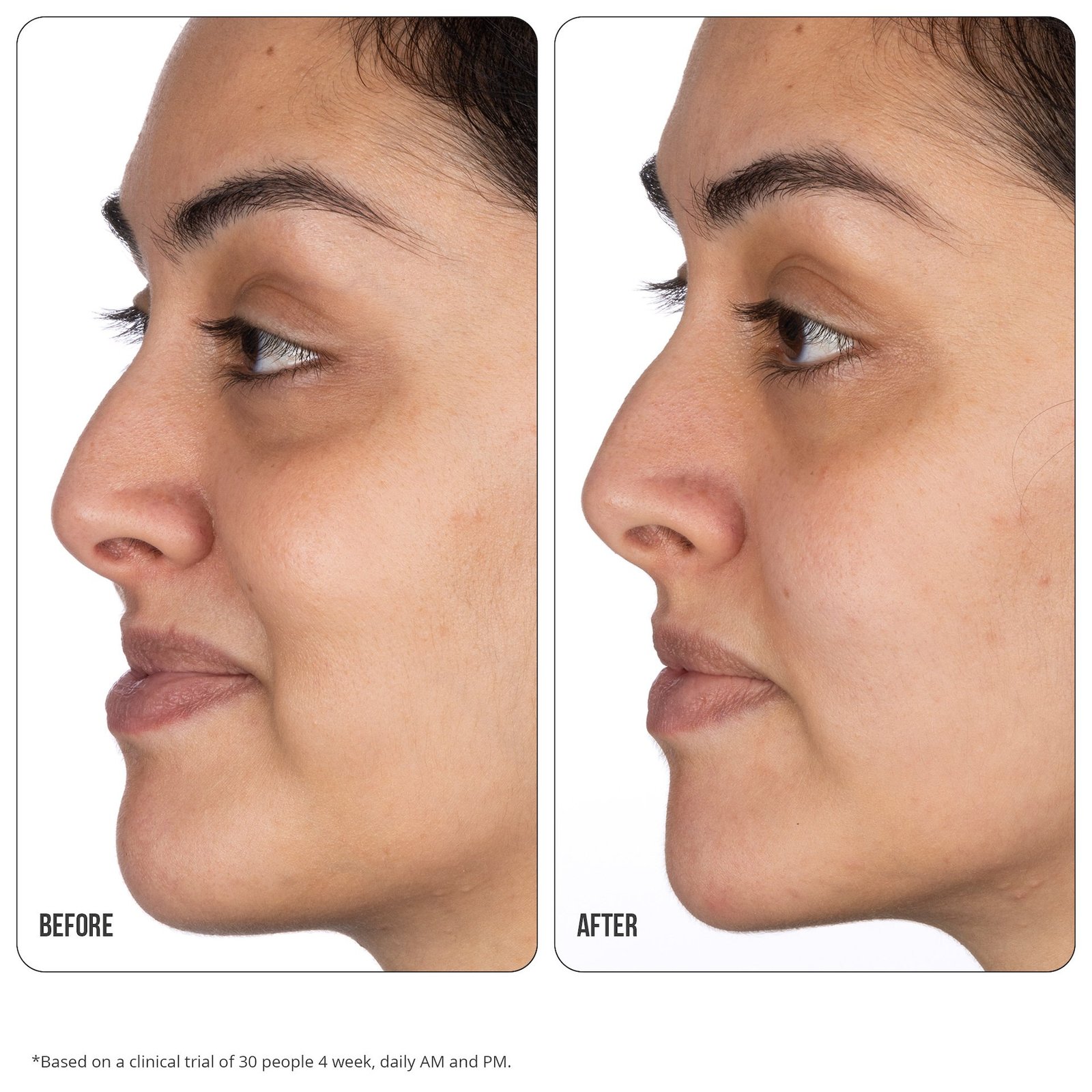 NIP+FAB Vitamin C 10% Fix Eye Cream 15 ml