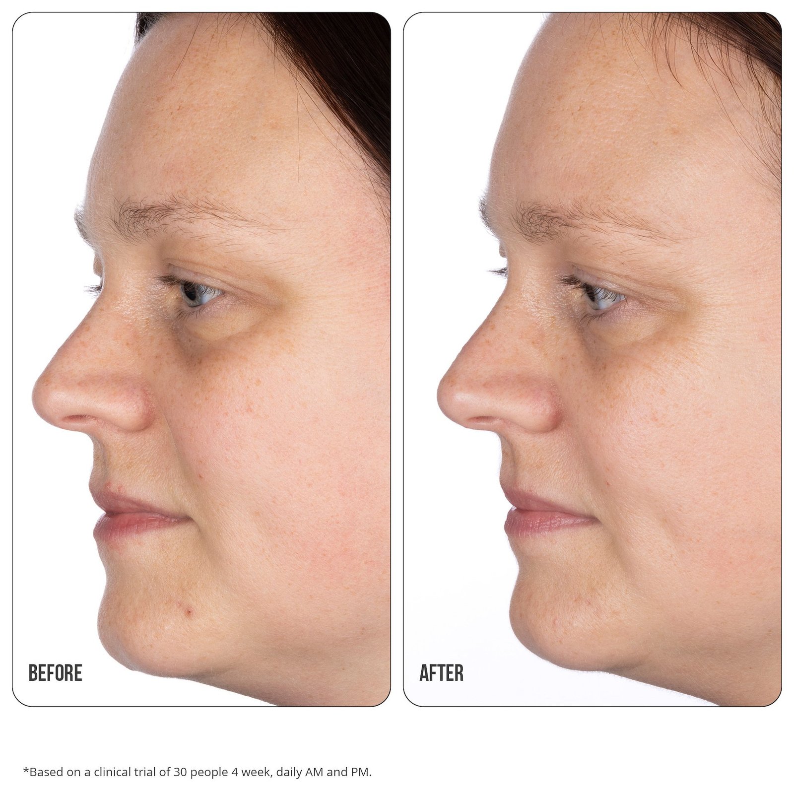 NIP+FAB Vitamin C 10% Fix Eye Cream 15 ml