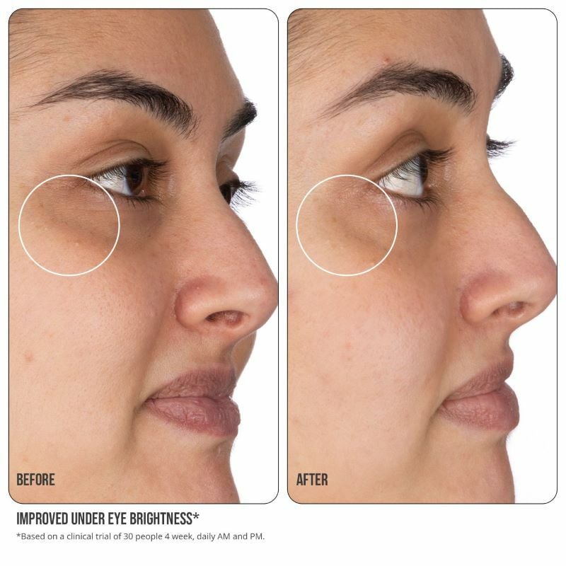 NIP+FAB Vitamin C 10% Fix Eye Cream 15 ml