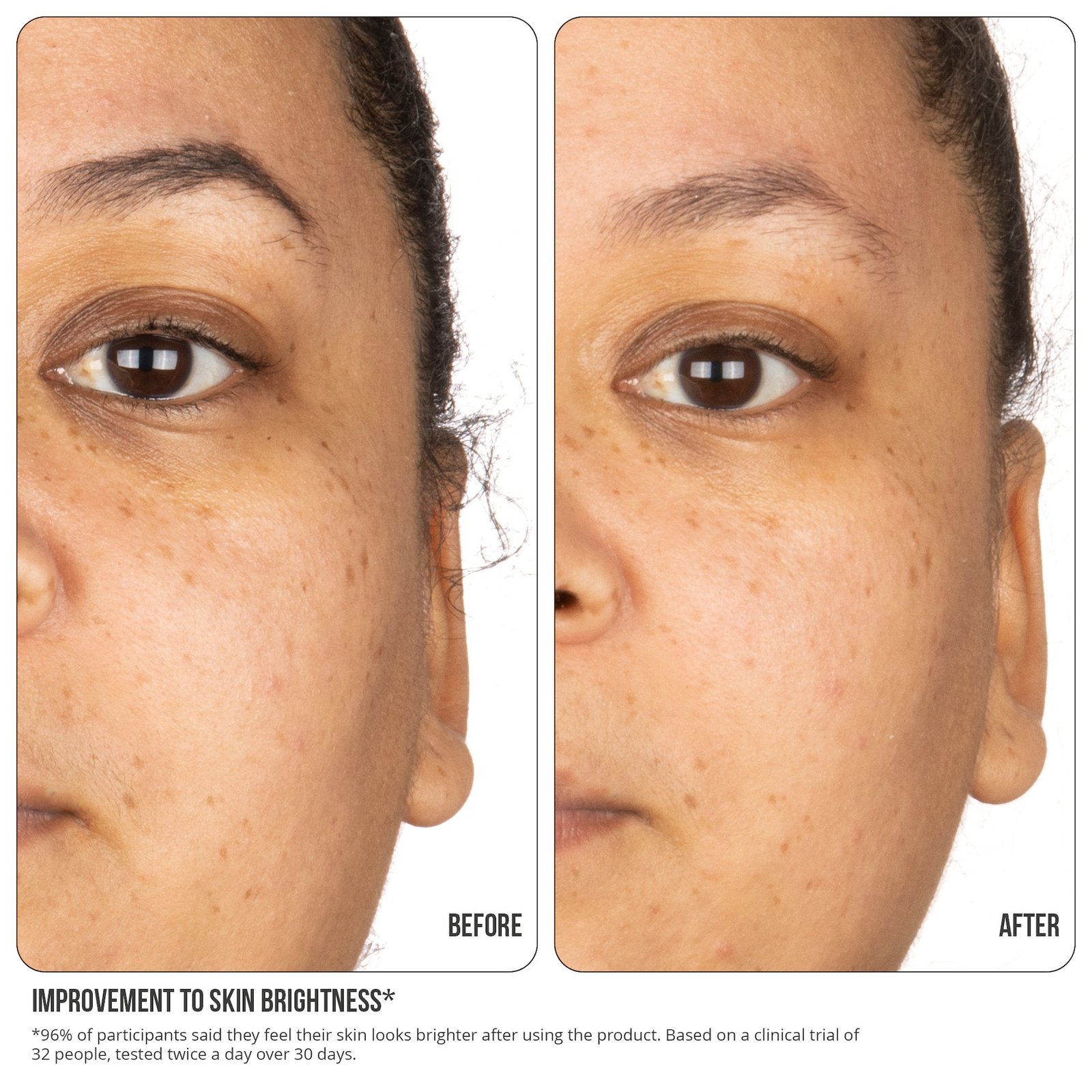 NIP+FAB Vitamin C Fix 15% Concentrate Extreme 30 ml