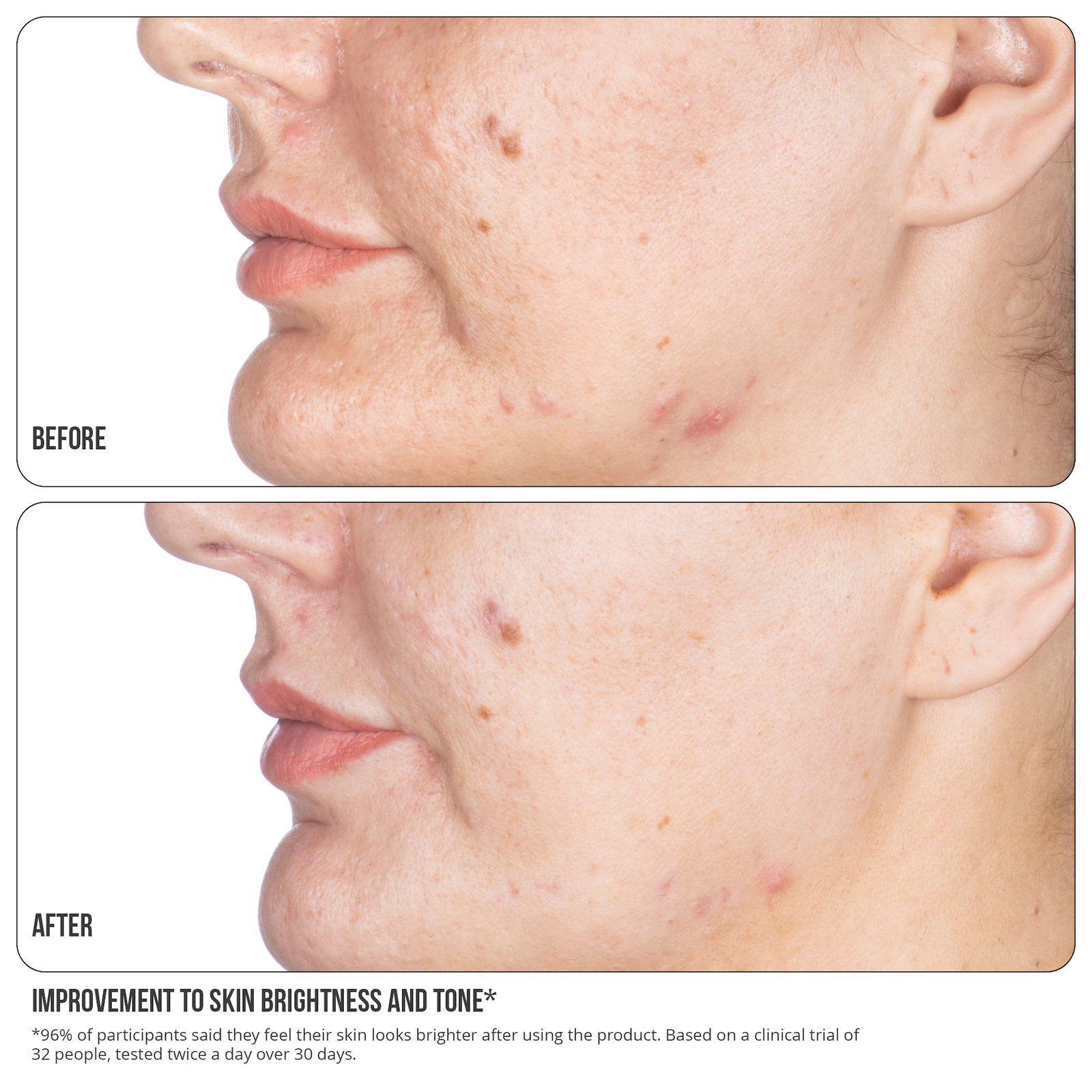 NIP+FAB Vitamin C Fix 15% Concentrate Extreme 30 ml