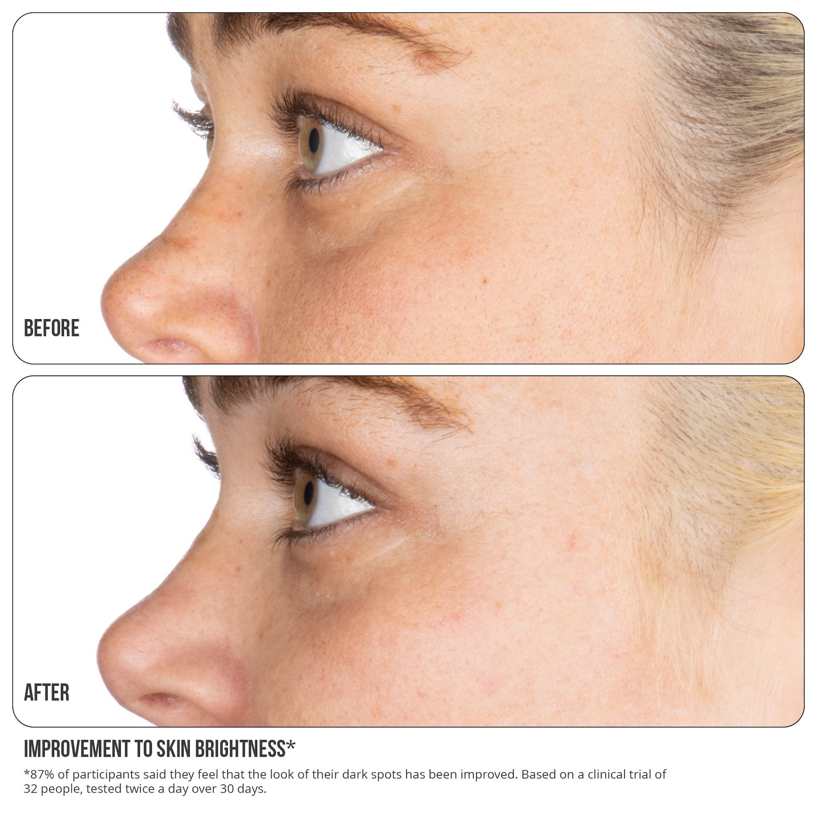 NIP+FAB Vitamin C Fix 15% Concentrate Extreme 30 ml