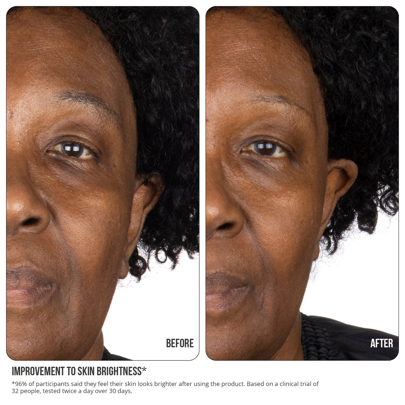 NIP+FAB Vitamin C Fix 15% Concentrate Extreme 30 ml