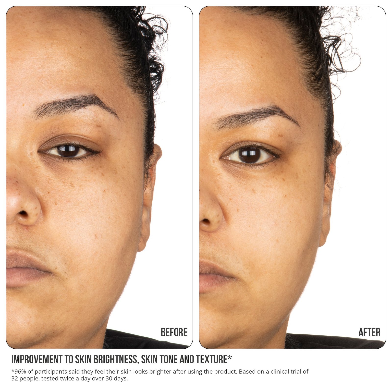 NIP+FAB Vitamin C Fix 15% Concentrate Extreme 30 ml