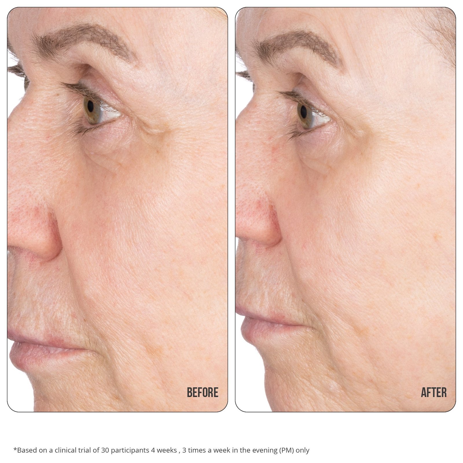 NIP+FAB Retinol Fix Concentrate Extreme 30 ml