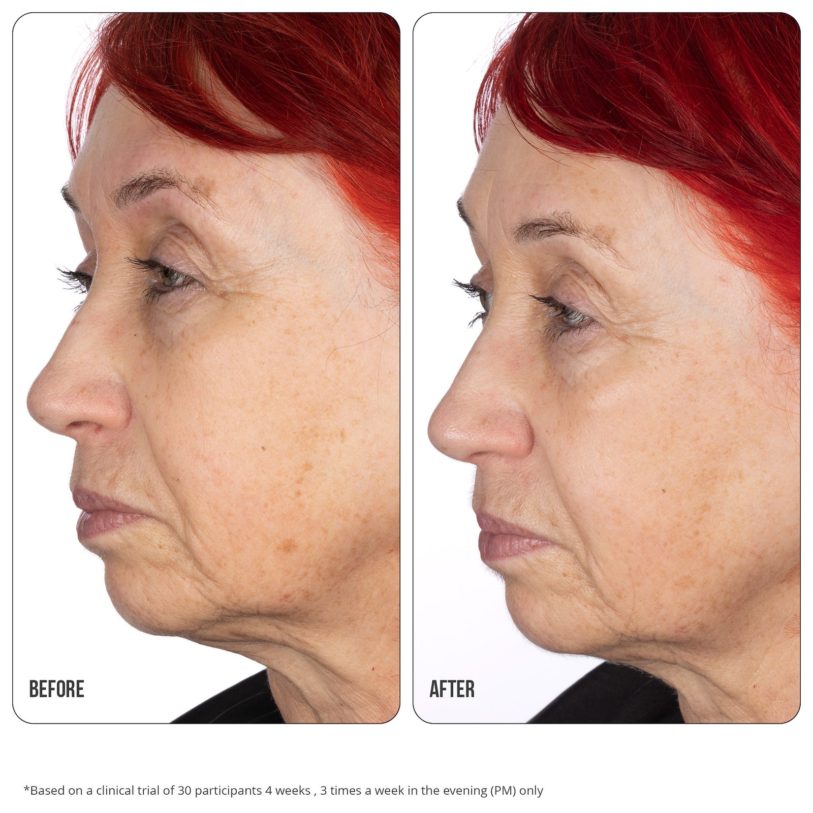 NIP+FAB Retinol Fix Concentrate Extreme 30 ml