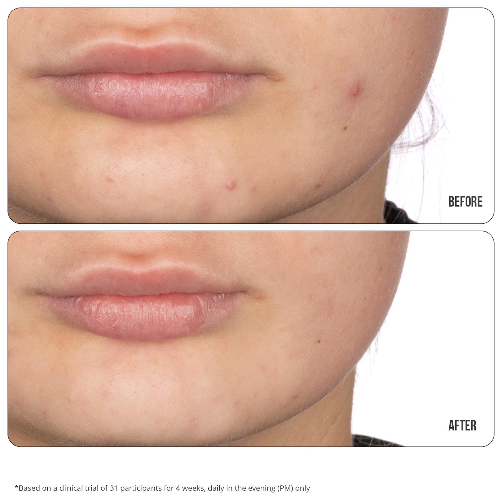 NIP+FAB Retinol Fix Blemish Gel 15 ml