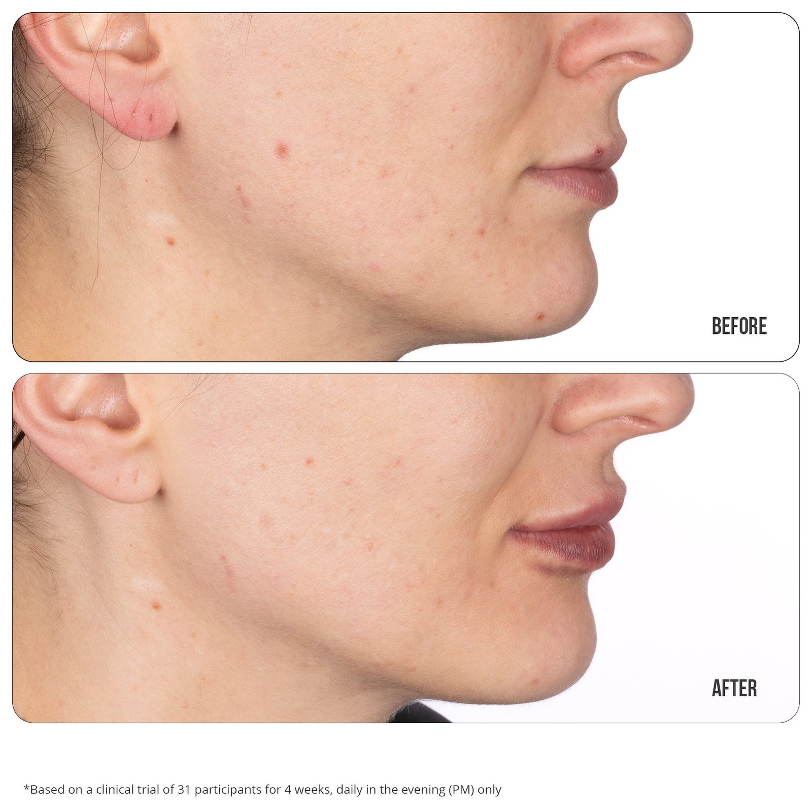 NIP+FAB Retinol Fix Blemish Gel 15 ml