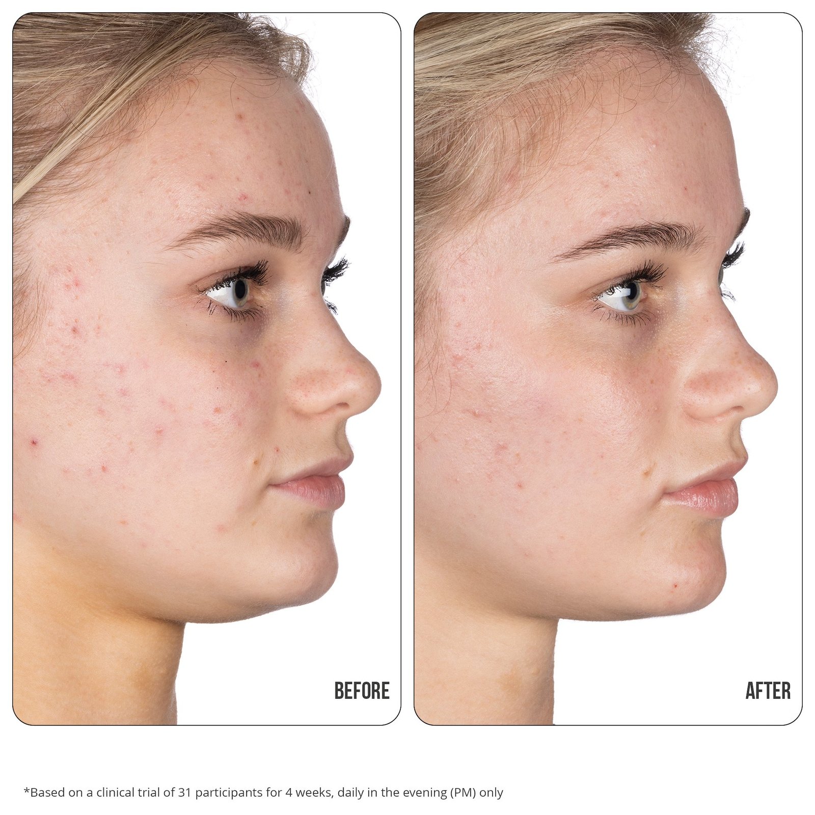 NIP+FAB Retinol Fix Blemish Gel 15 ml