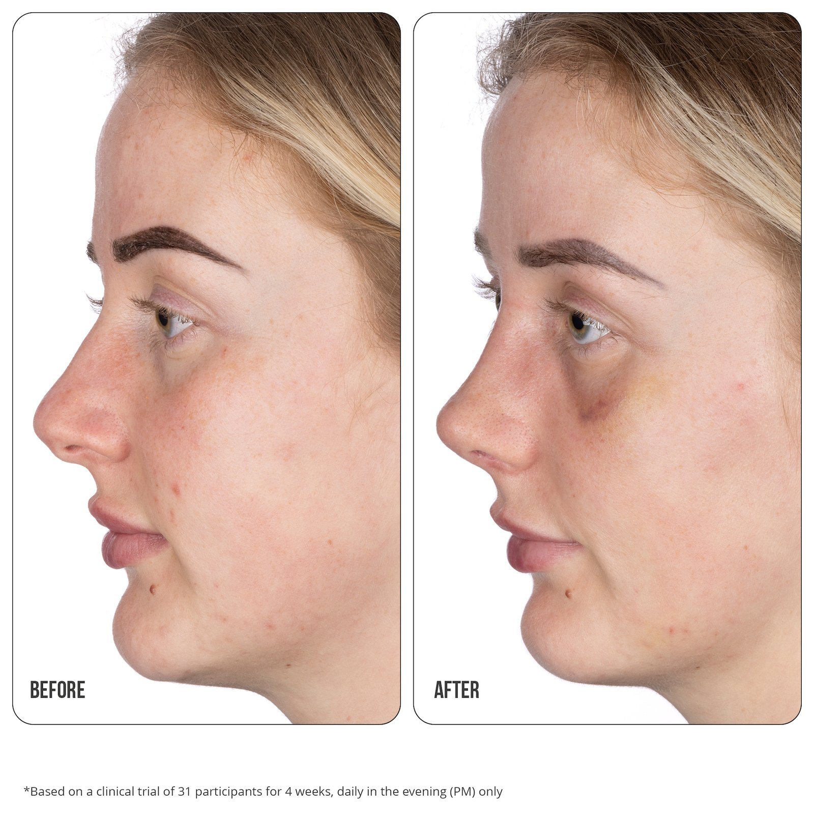 NIP+FAB Retinol Fix Blemish Gel 15 ml