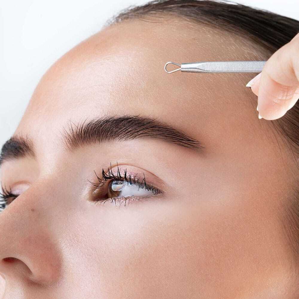 Brushworks Blackhead & Blemish Remover Set