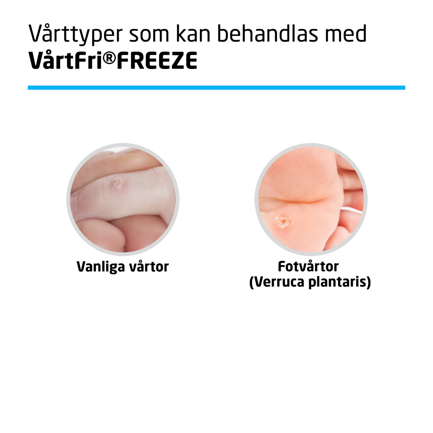 VårtFri Freeze 21 ml