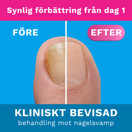 Nalox Forte 30 ml