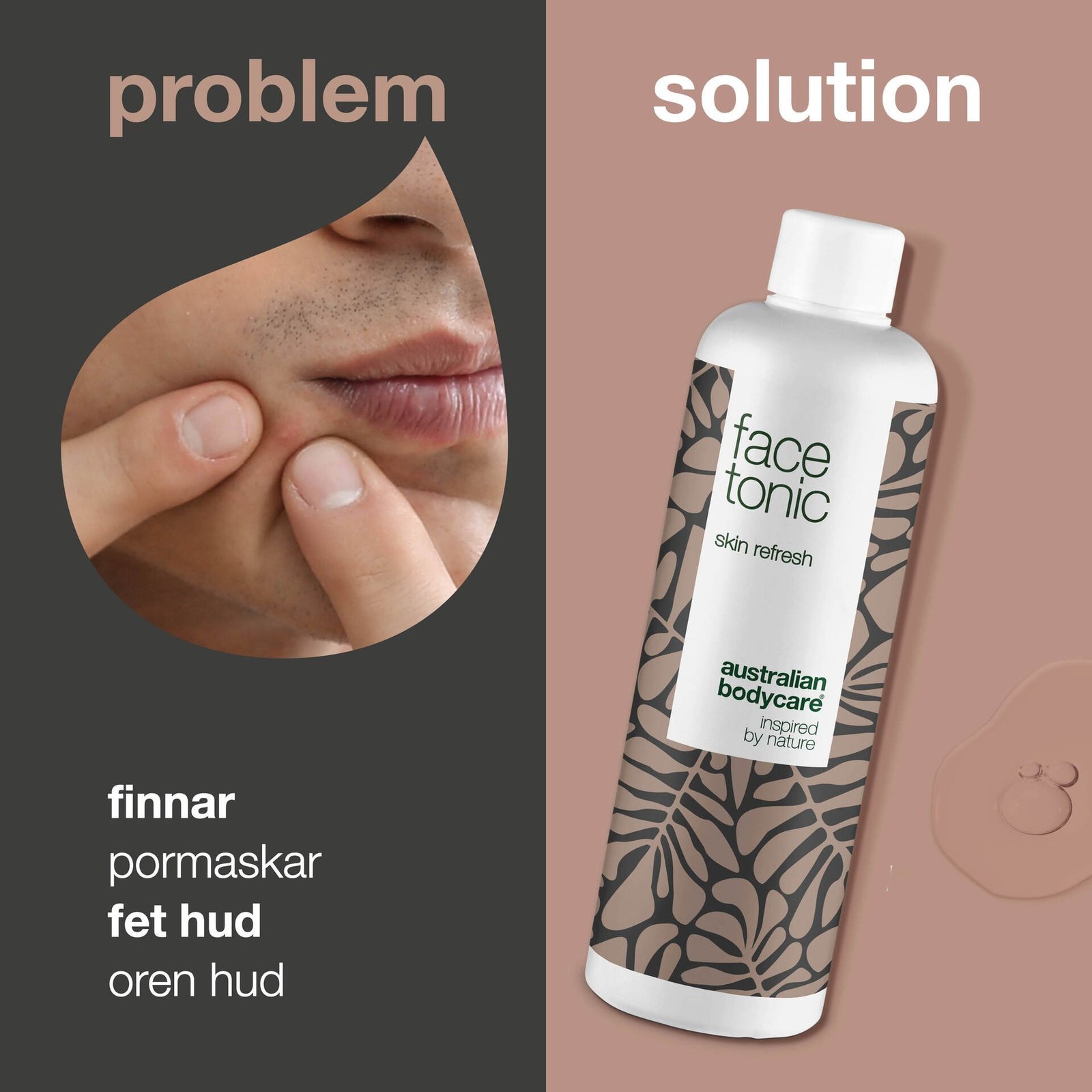 Australian Bodycare Toner mot finnar 150 ml