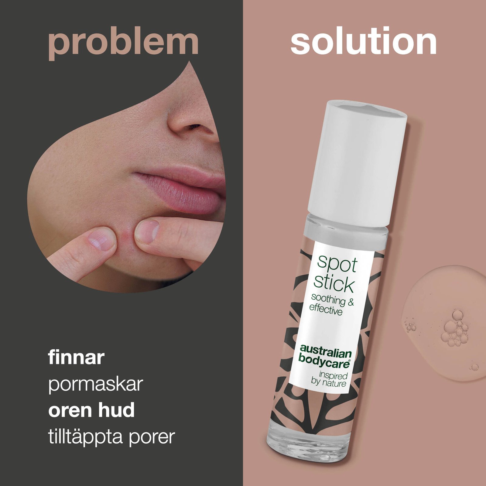 Australian Bodycare Spot Stick Punktbehandling mot finnar 9 ml