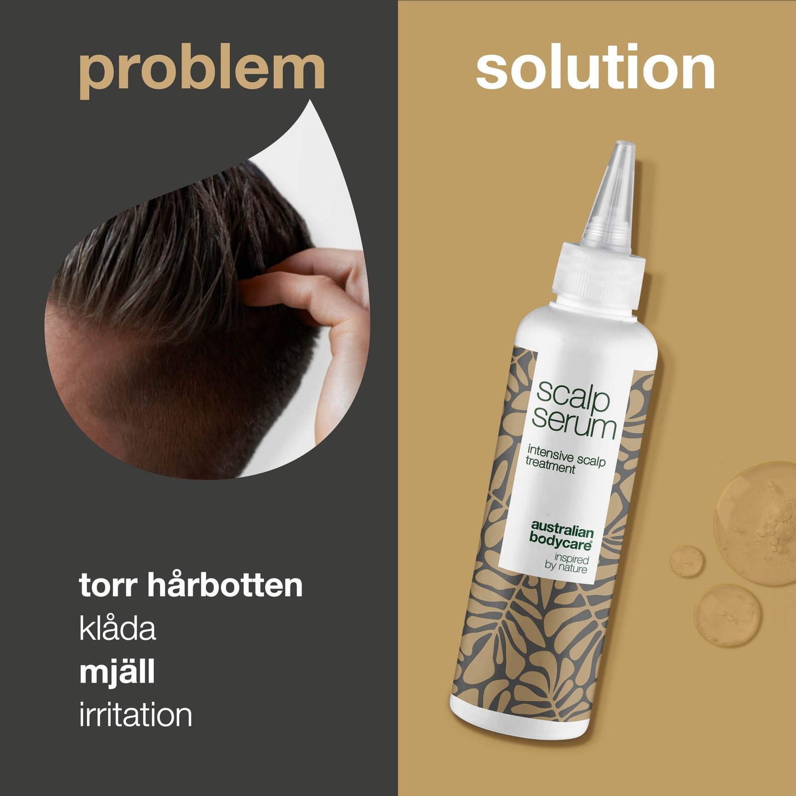 Australian Bodycare Scalp Serum mot mjäll, torr och kliande hårbotten 150 ml