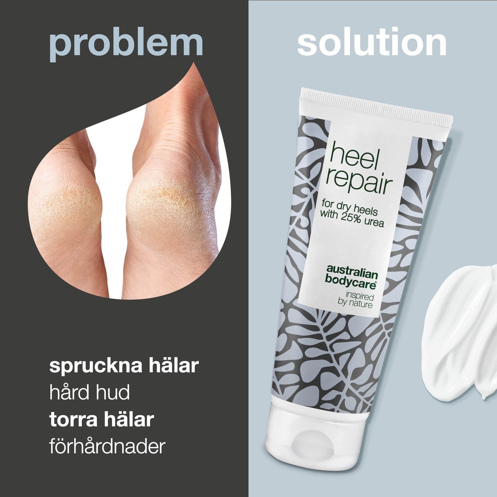 Australian Bodycare Hälkräm 25% Urea för hälsprickor 100 ml