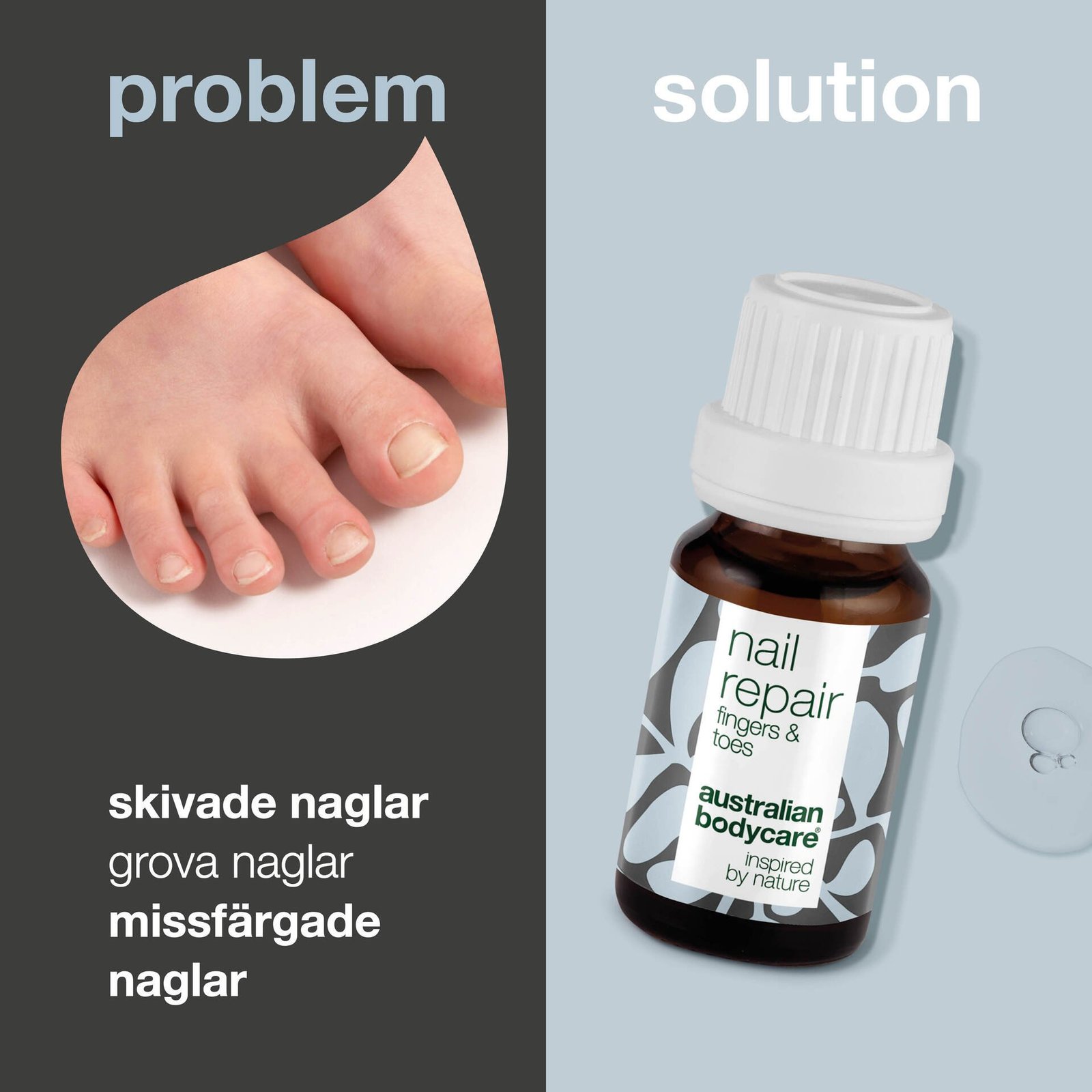 Australian Bodycare Nagelolja för skivade och gula naglar 10 ml