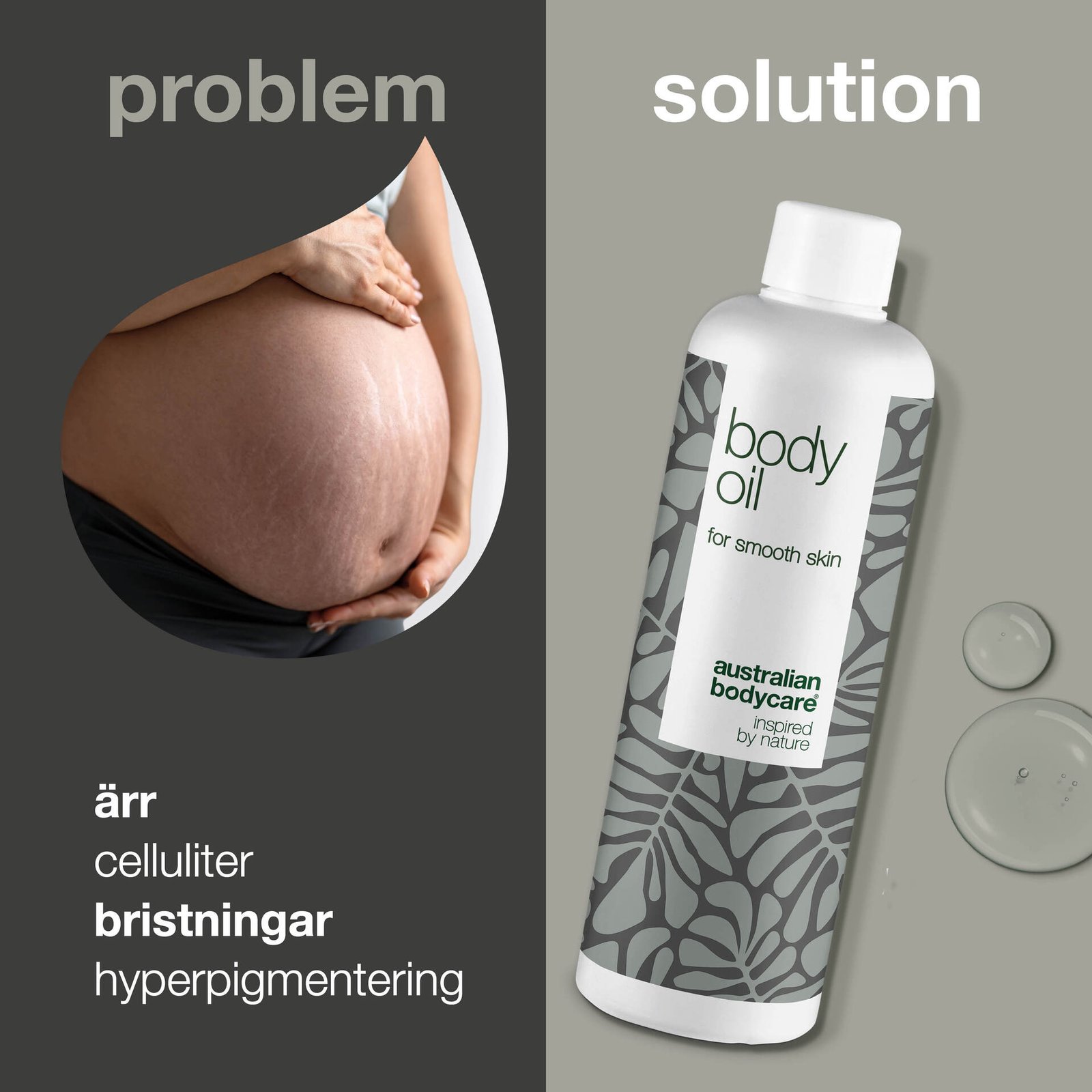 Australian Bodycare Kroppsolja vid bristningar och ärr 150 ml