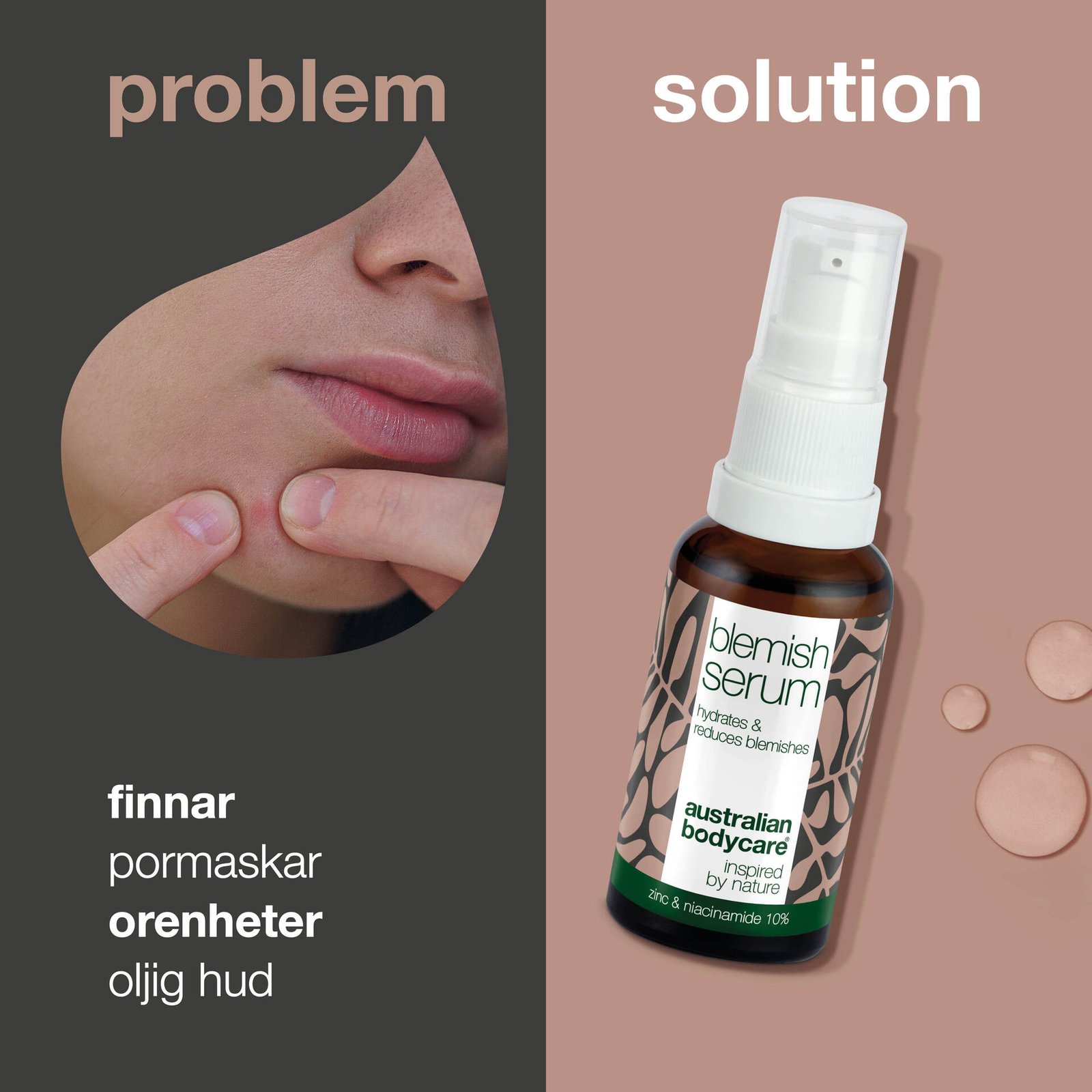 Australian Bodycare Niacinamide Serum 10% mot oren hud 30 ml