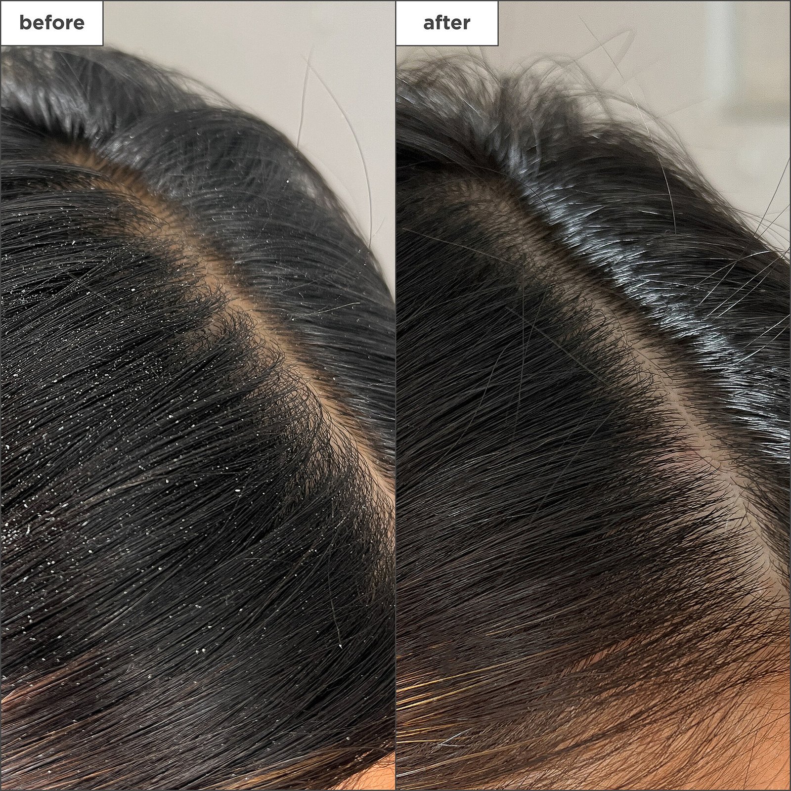 Briogeo Scalp Revival™ Buildup Detox Spray 120 ml