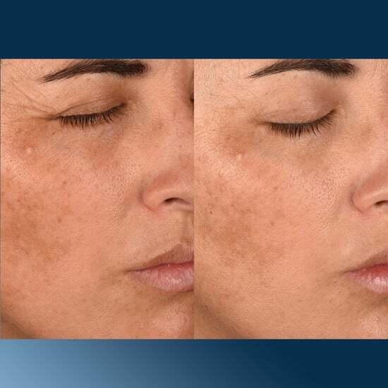 Dermalogica Pro-Collagen Banking Water Cream 50ml