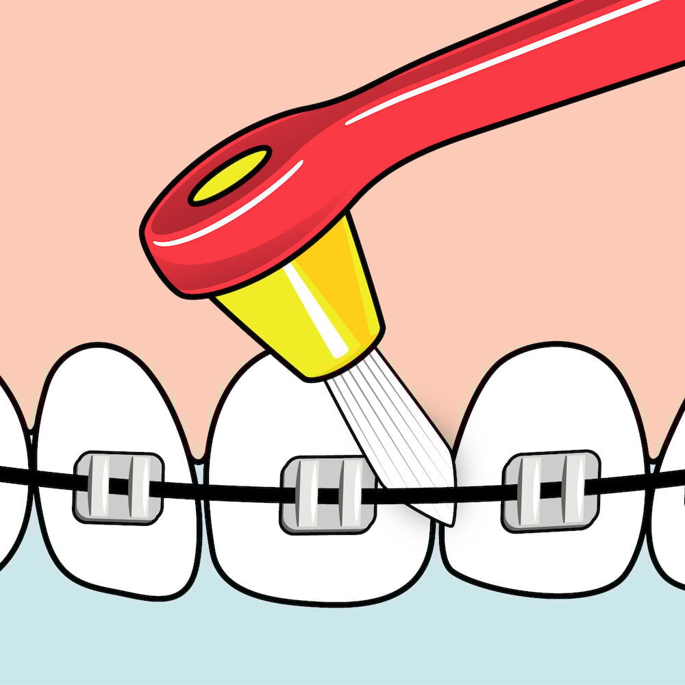 TePe Interspace Soft Vinkelborste 1 skaft + 12 tippar