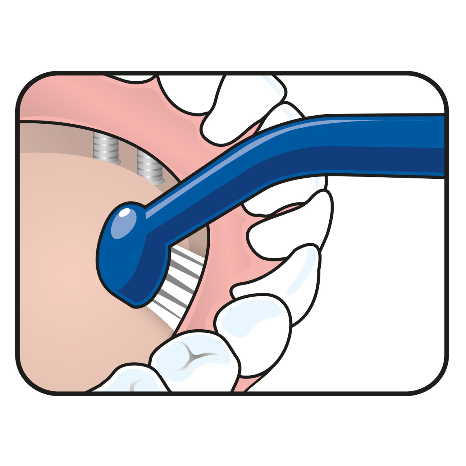 TePe Universal Care Vinklad borste 1-pack