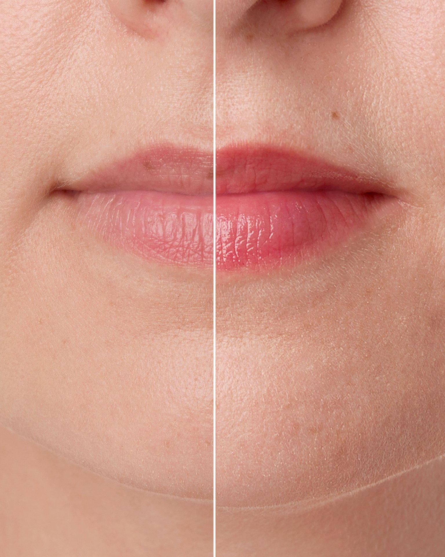 Skinome Lip Repair Natural Pink 15 ml