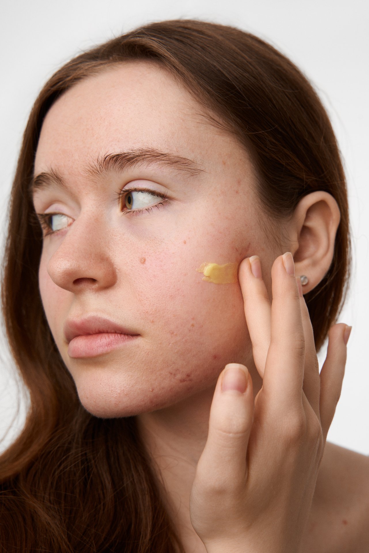 Skinome Azeretinal Concentrate 30 ml